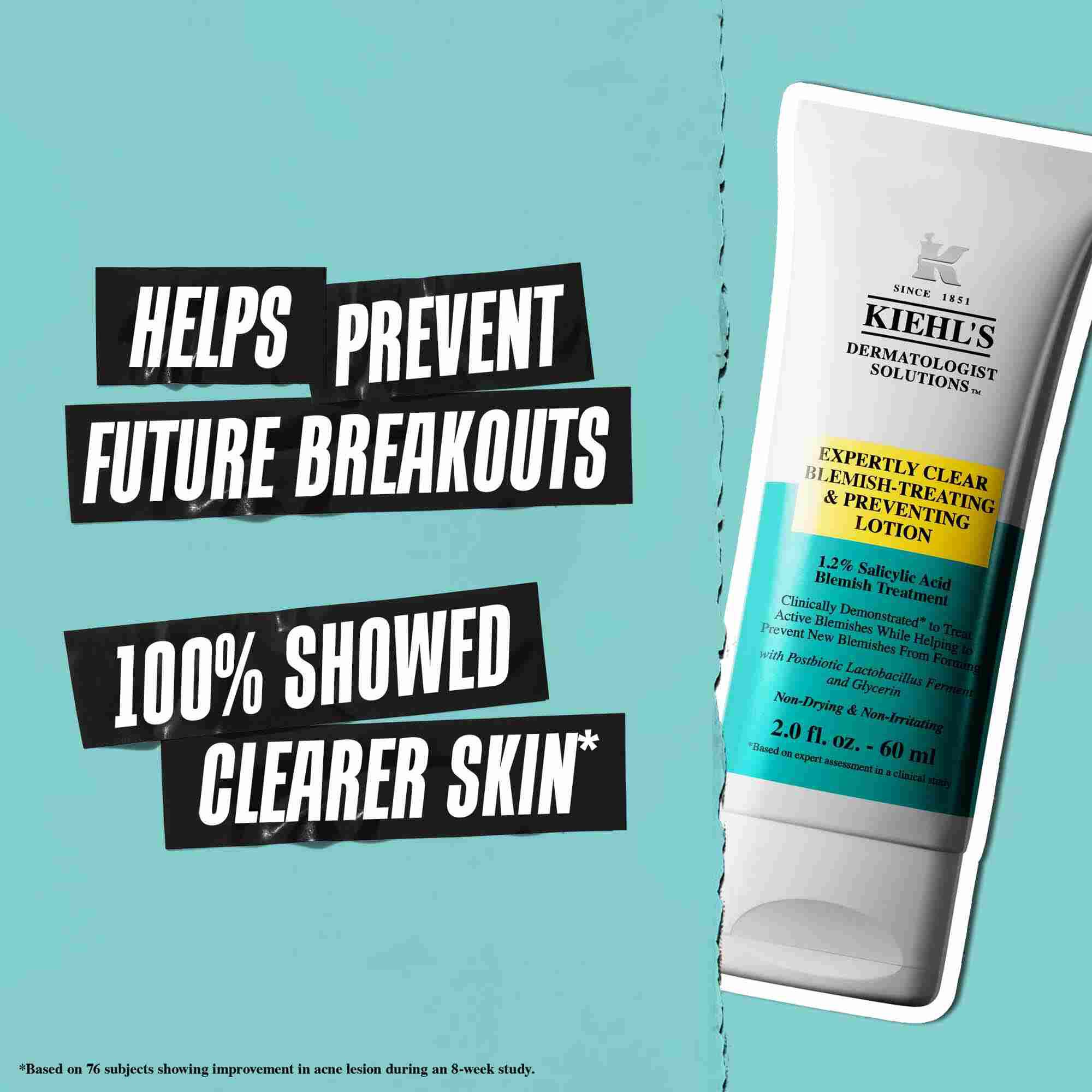 Un tubetto di Expertly Clear Blemish-Treating & Preventing Lotion su sfondo blu con testo che recita: "Aiuta a prevenire future eruzioni cutanee" e "Il 100% ha mostrato una pelle piu pulita".