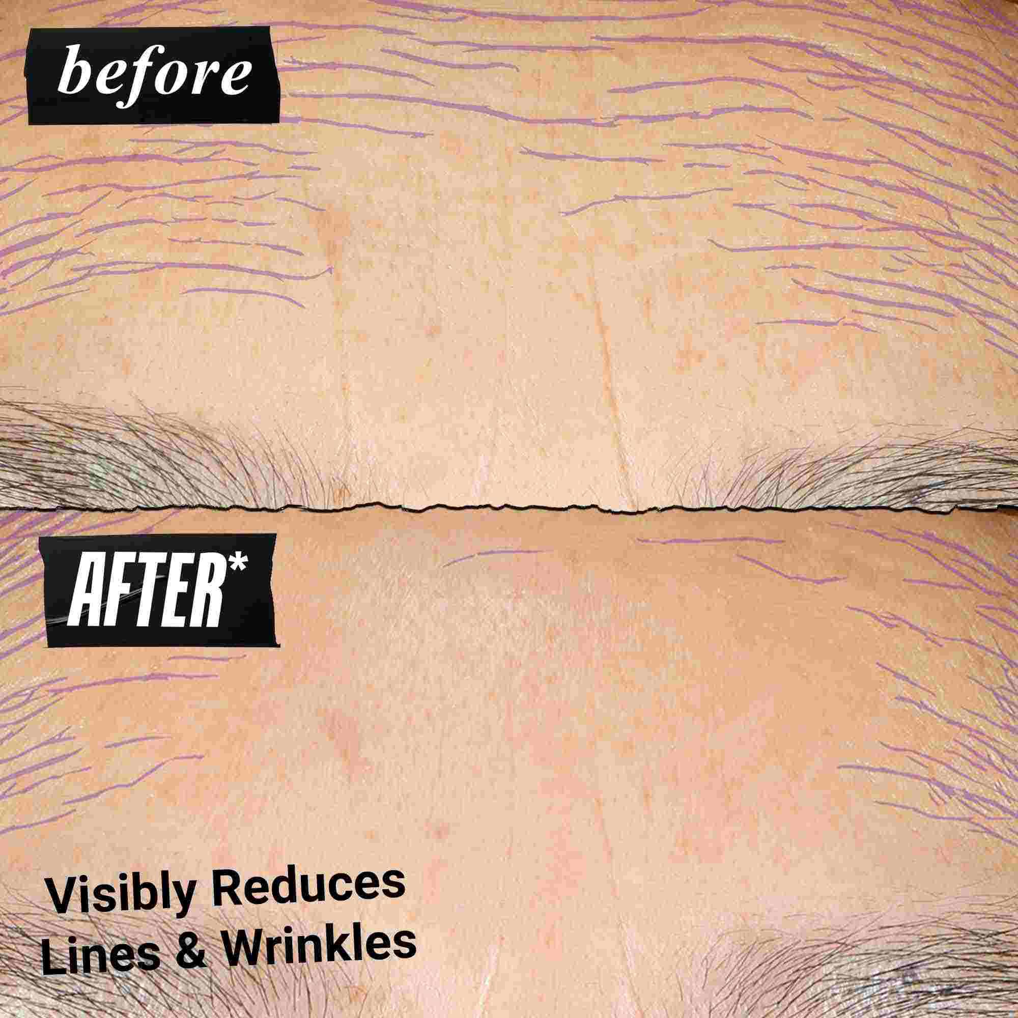 Foto prima e dopo: Kiehl's Retinol Skin-Renewing Daily Micro-Dose Serum aiuta a migliorare il tono e la grana della pelle