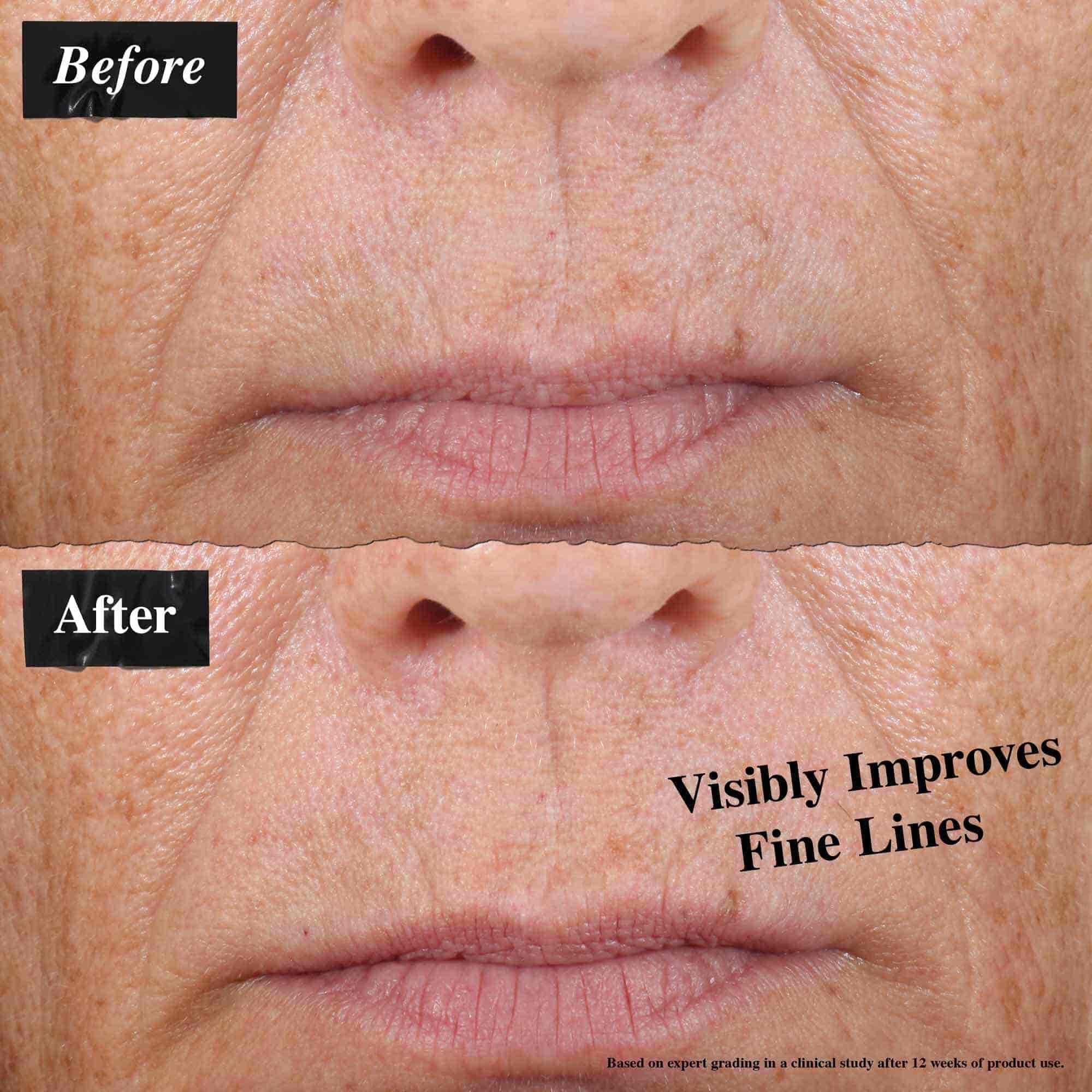 Un confronto prima e dopo che mostra linee sottili visibilmente ridotte dopo l'uso dell'olio viso Midnight Recovery Concentrate.