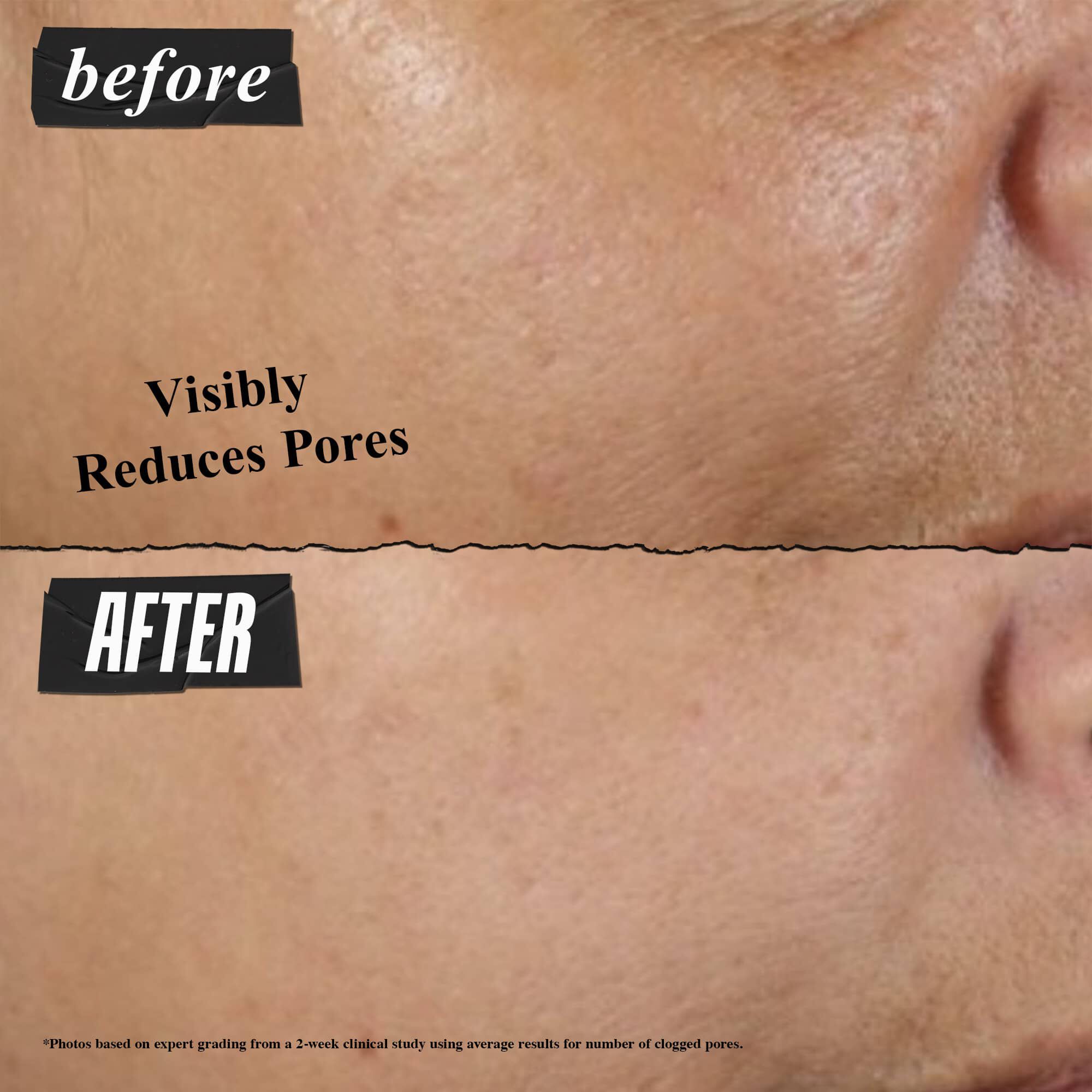 Rare Earth Deep Pore Cleansing Masque