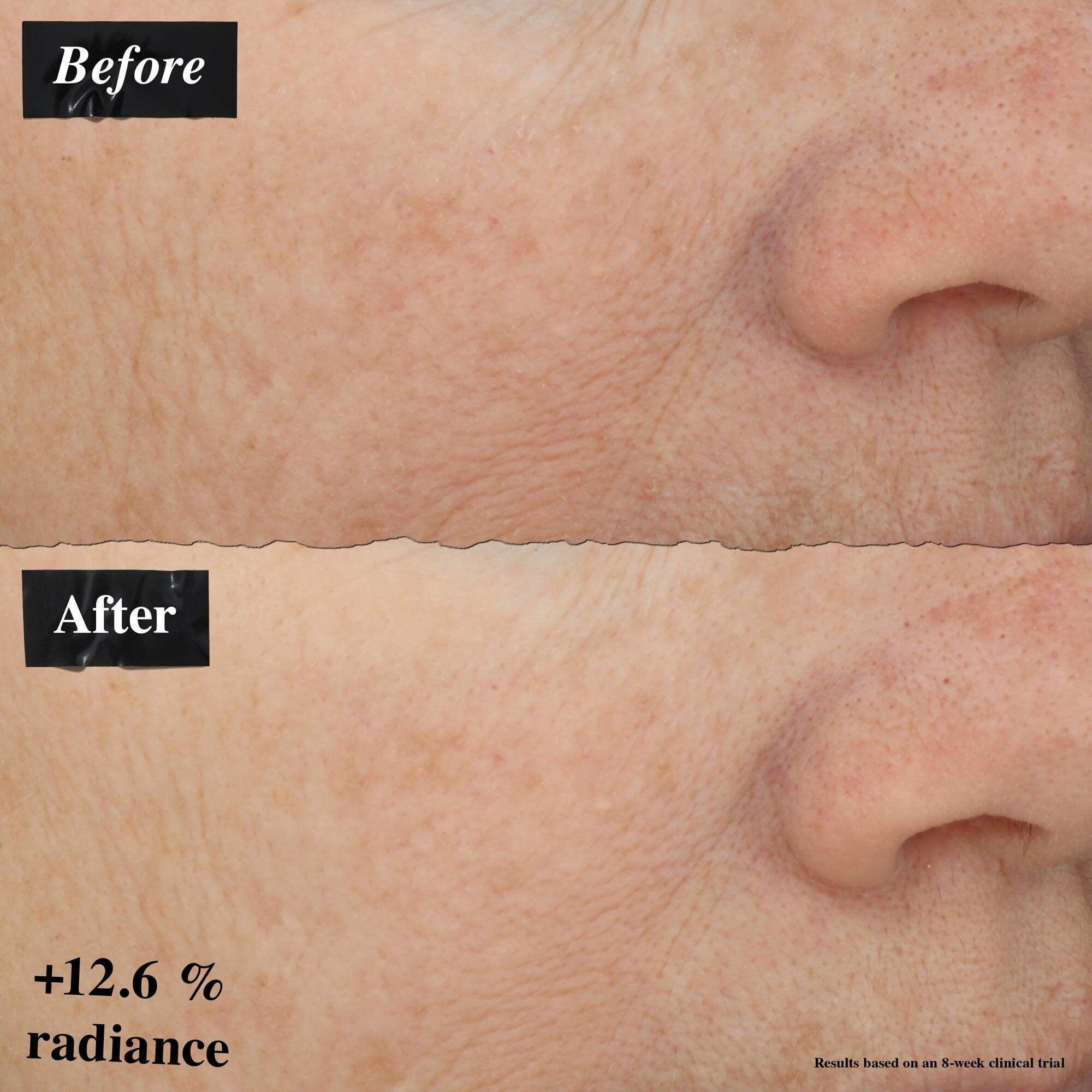 Un confronto di immagini prima e dopo che mostra un miglioramento del rossore della pelle dopo l'uso di Powerful-Strength Line-Reducing Concentrate.