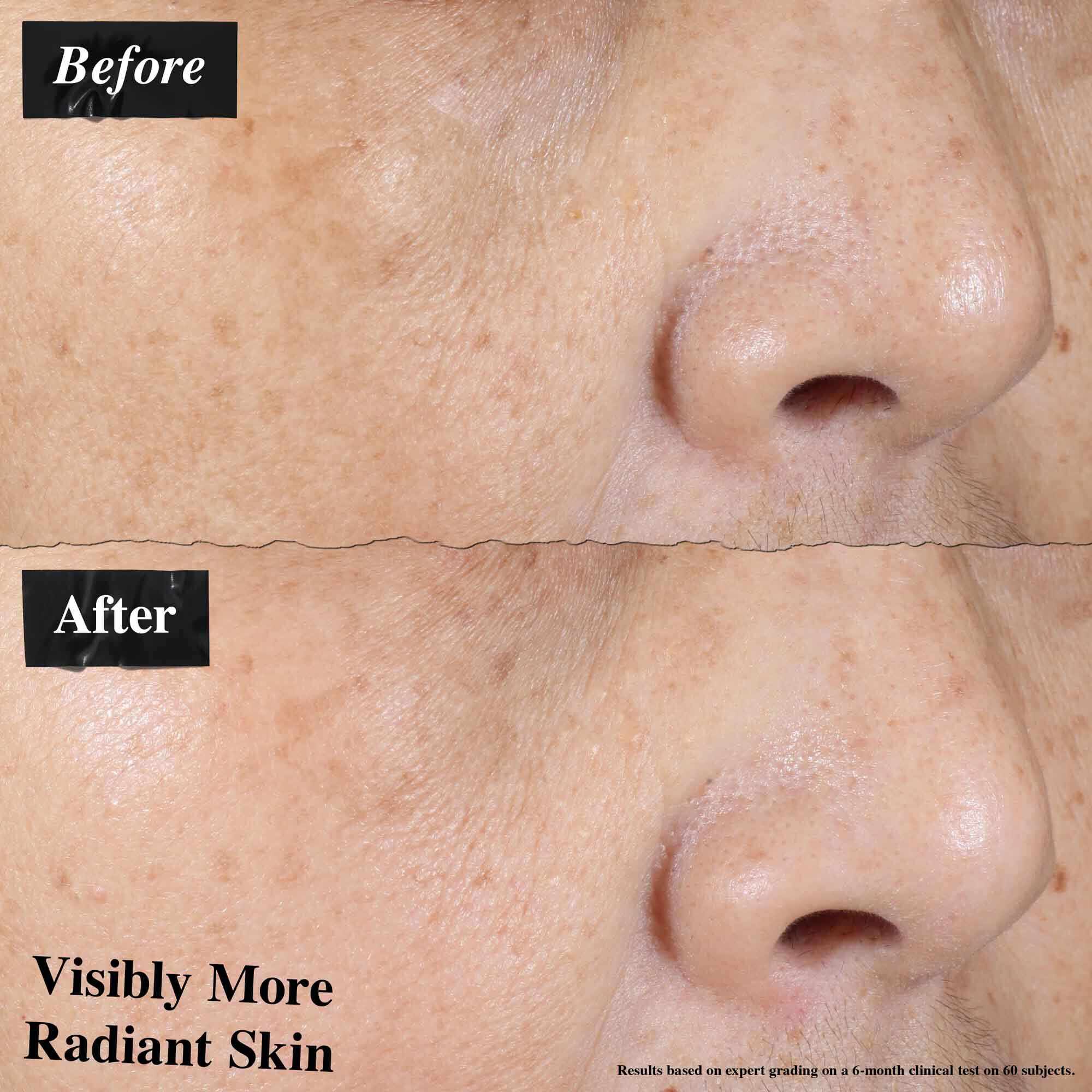 Confronto prima e dopo che mostra un rossore della pelle visibilmente ridotto dopo l'uso di Ultra-Light Daily UV Defense.