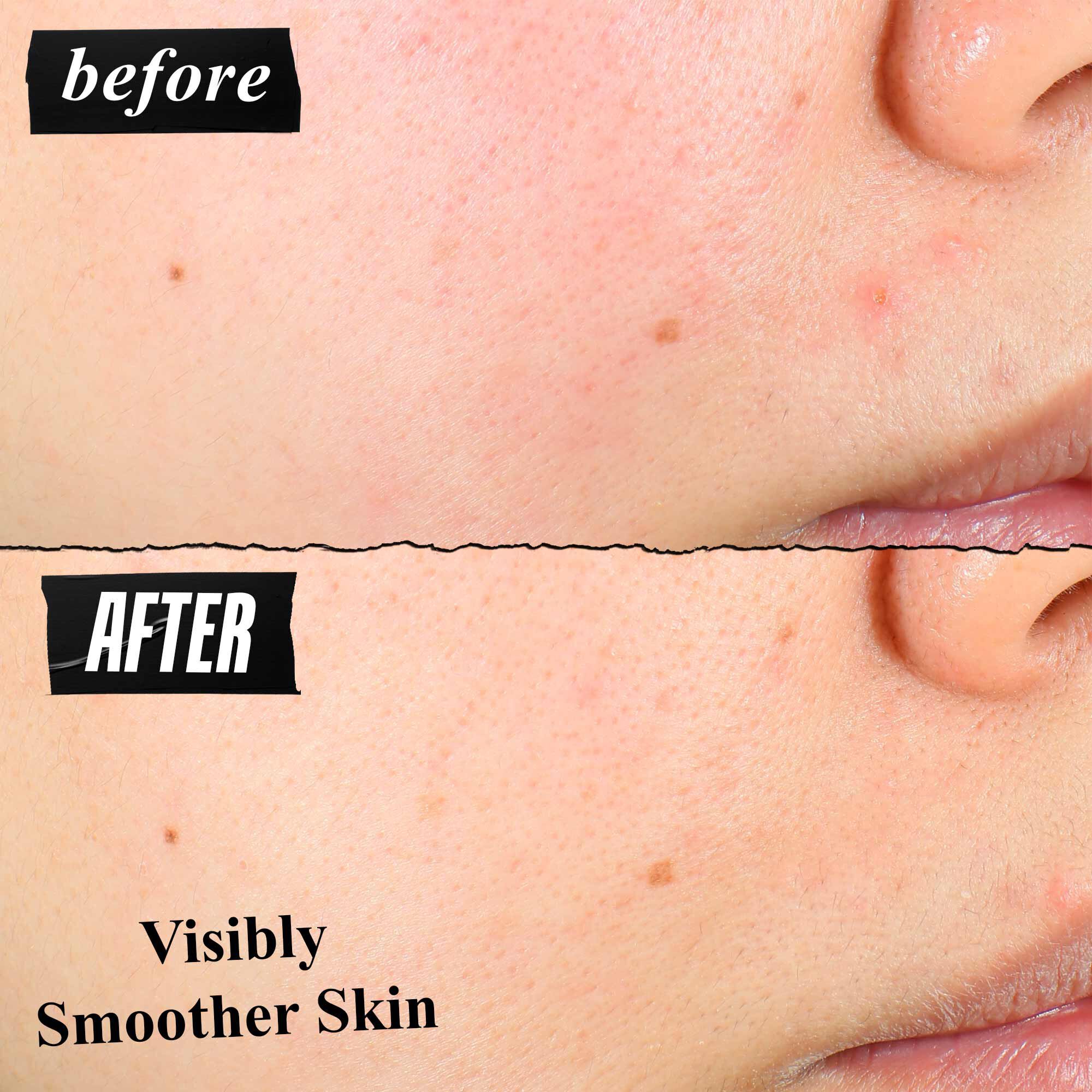 Un confronto prima e dopo della texture della pelle che mostra una pelle visibilmente piu liscia dopo l'uso.