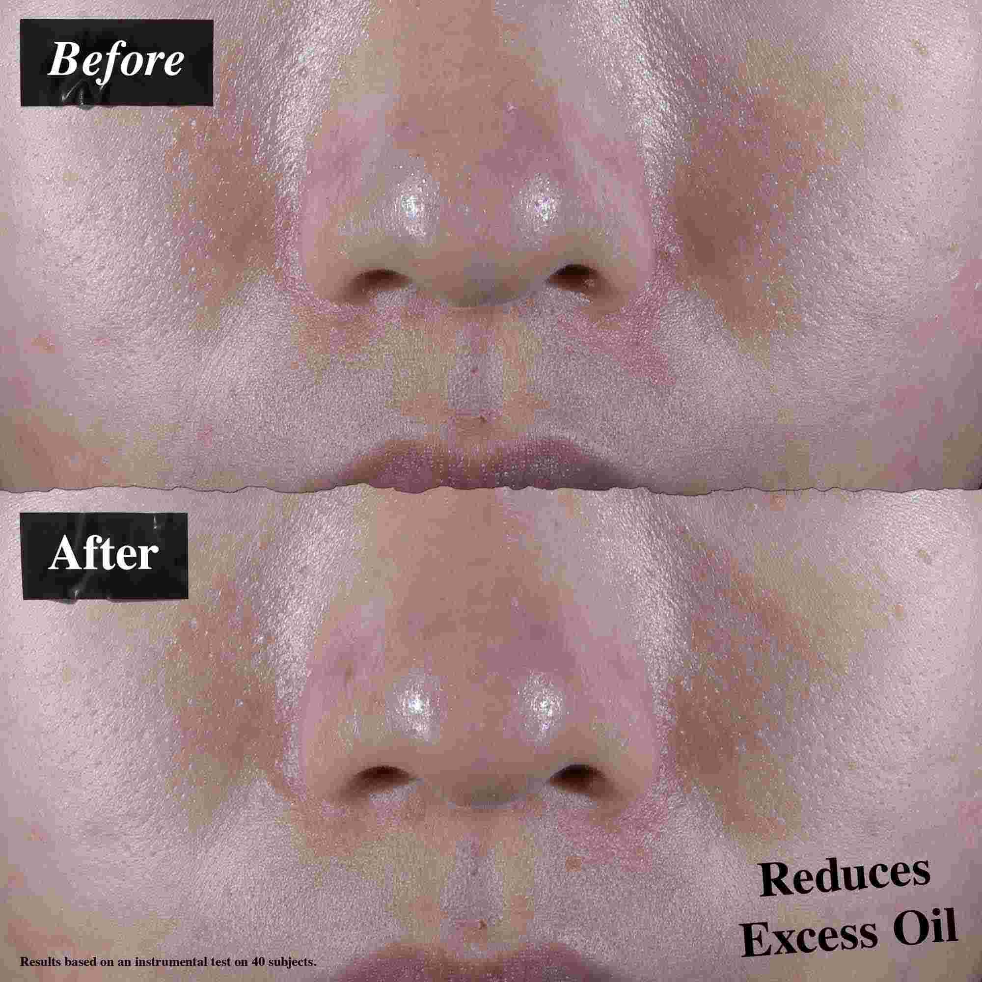 Confronto prima e dopo che mostra una riduzione dell'olio in eccesso dopo l'uso di Ultra Facial Oil-Free Gel Cream.