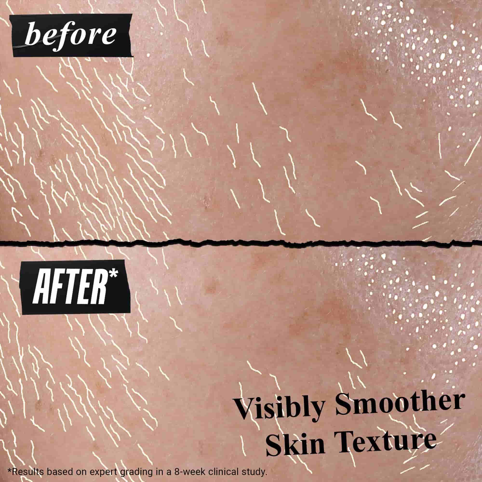 Risultati prima e dopo di Better Screen UV Serum sulla pelle