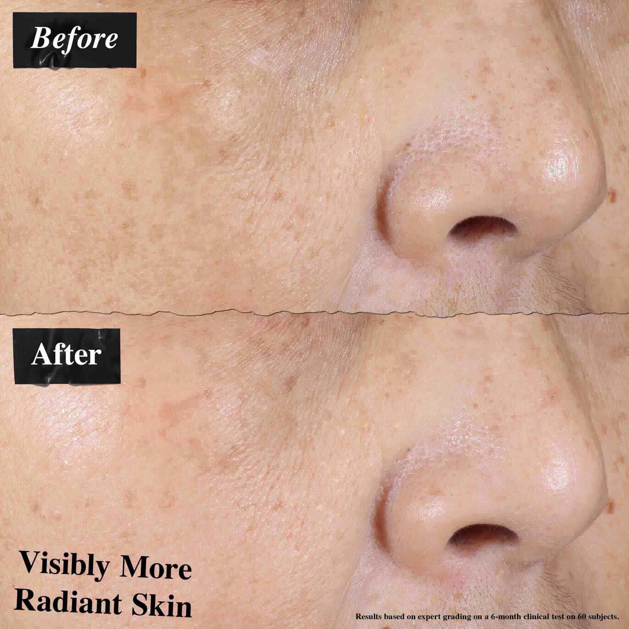 Confronto prima e dopo che mostra un rossore della pelle visibilmente ridotto dopo l'uso di Ultra-Light Daily UV Defense.