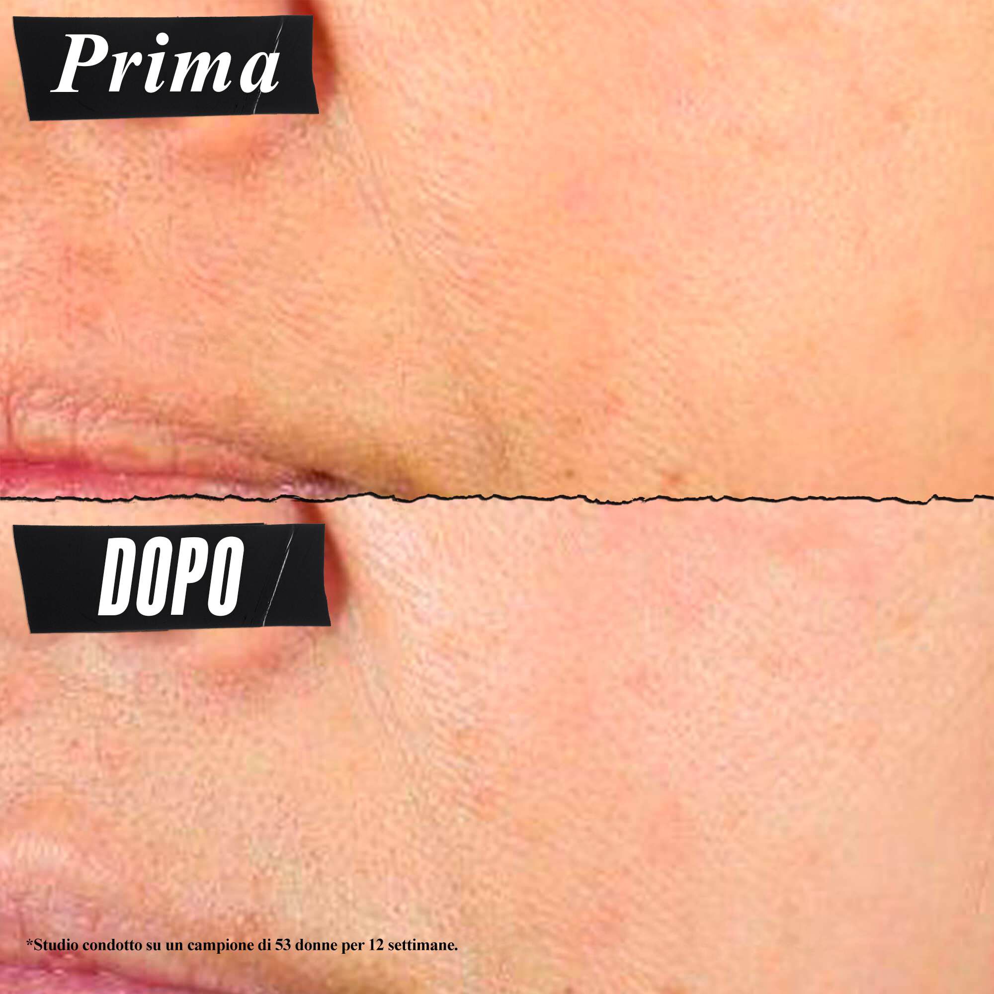 Foto prima e dopo: Kiehl's Super Multi-Corrective Cream aiuta a migliorare i segni visibili della perdita di collagene