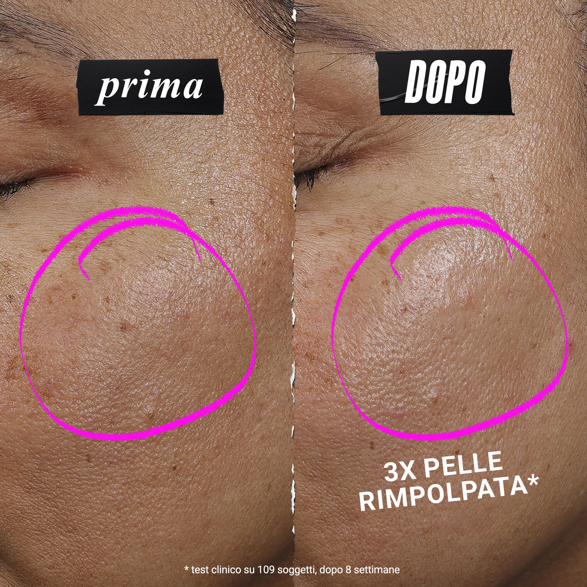 1cc* CollaShot Plump Serum