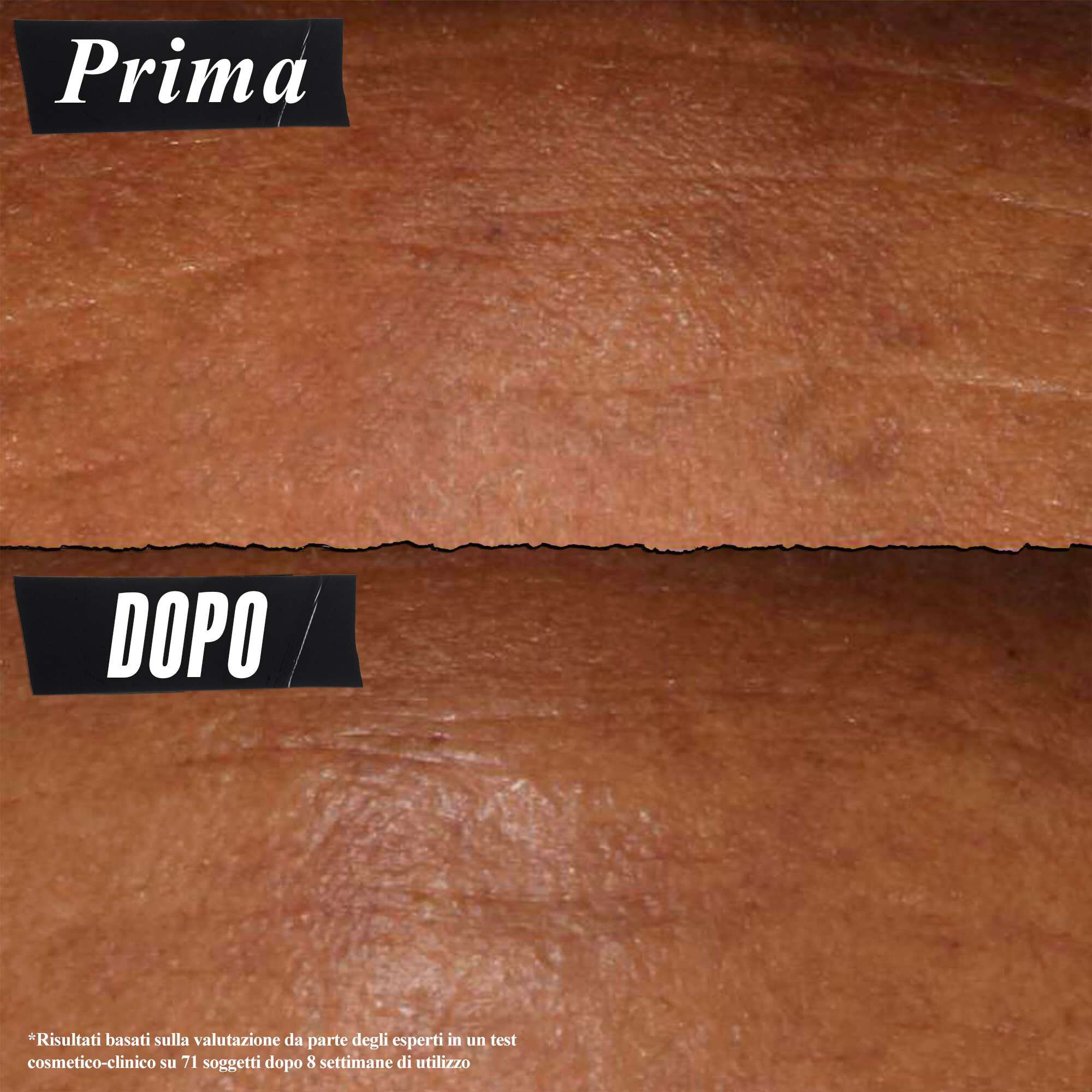 Foto prima e dopo: il siero notte Kiehl's Retinol Fast Release riduce visibilmente le rughe