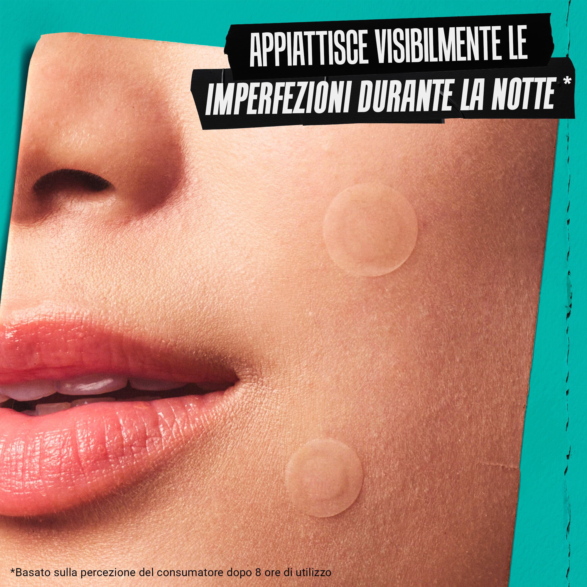 A person's face with blemish patches applied, illustrating how the product "Visibly Flattens Blemishes Overnight."