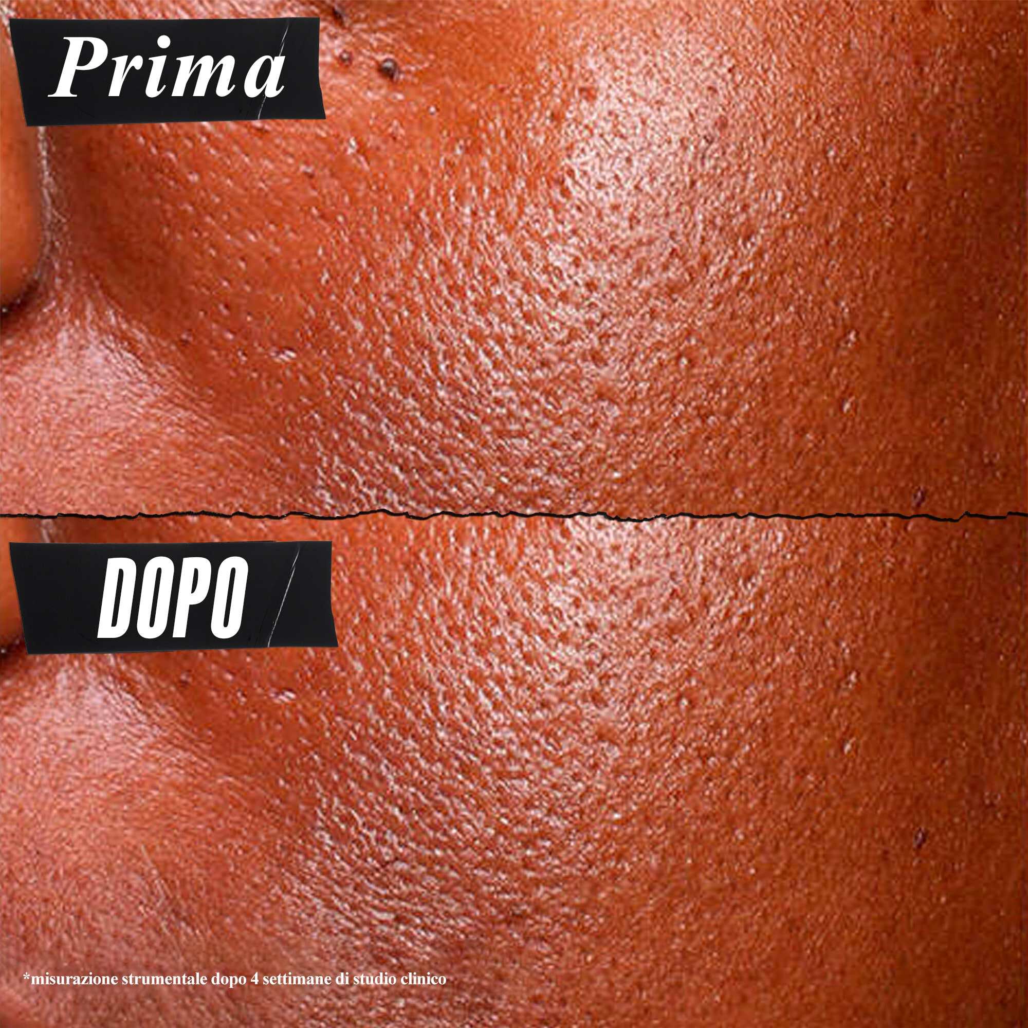 Foto prima e dopo: Kiehl's Ultra Pure High-Potency Serum riduce visibilmente il sebo in eccesso