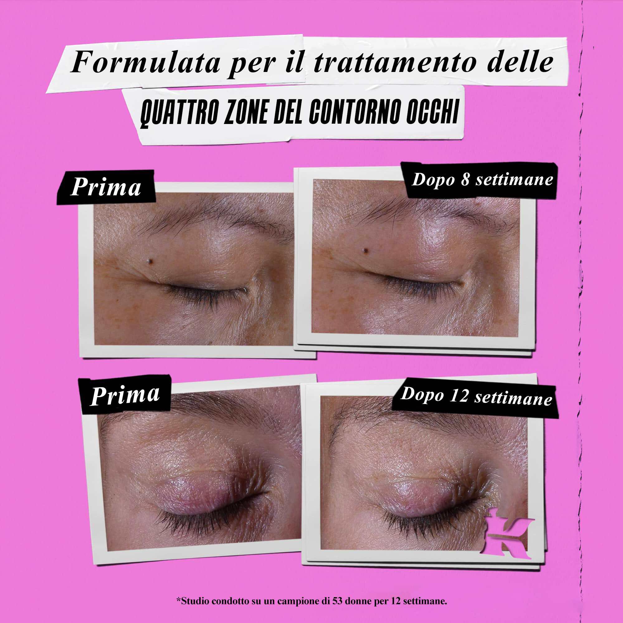 Foto prima e dopo: Kiehl's Super Multi-Corrective Eye Zone Treatment corregge i segni dell'invecchiamento