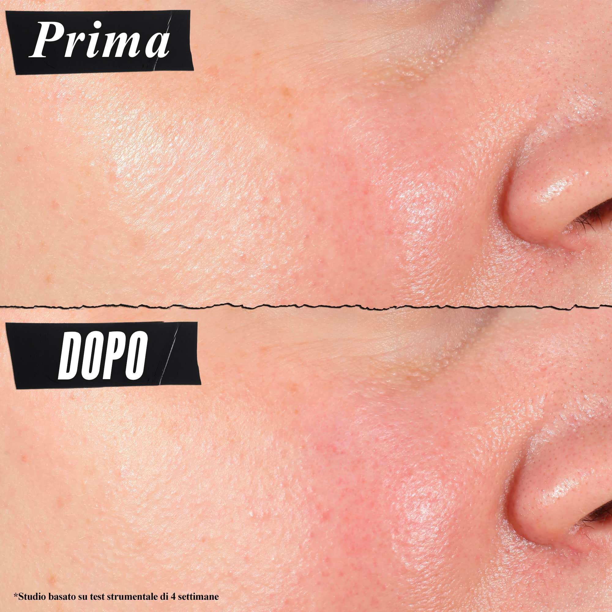 Foto prima e dopo: Kiehl's Hydro Plumping Serum Concentrate riduce visibilmente i pori