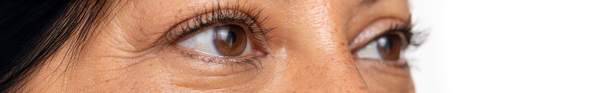 sguardo di donna con evidenza di linee sottili